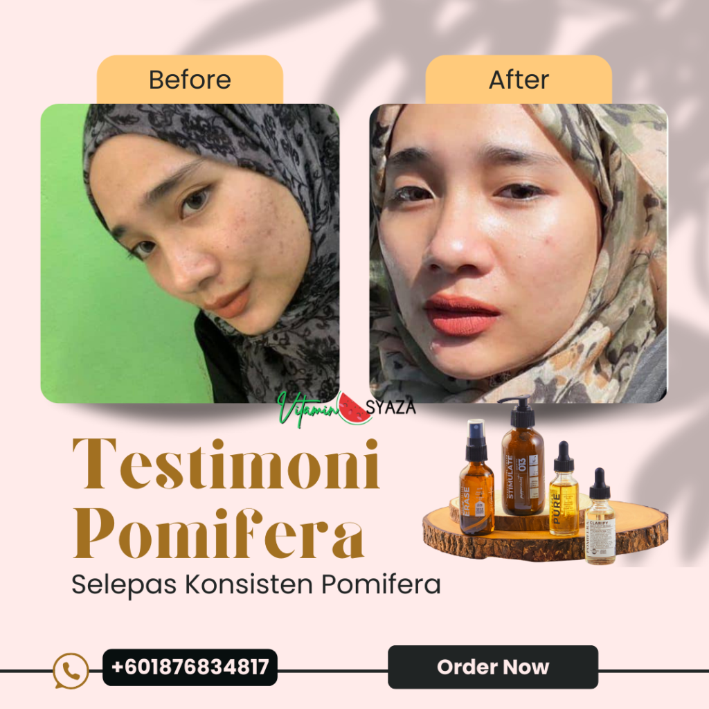 Testimoni Pomifera Shaklee